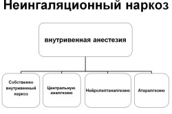 Неингаляционный наркоз Неингаляционный наркоз