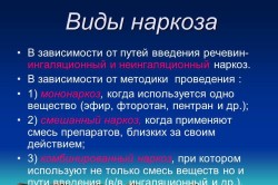 Виды наркоза