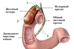 Лапароскопия желчного пузыря