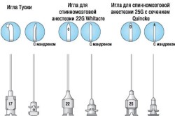 Иглы для эпидуральной анестезии